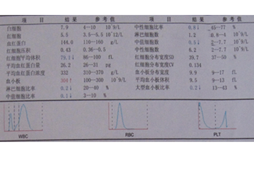 [贴图]希森美康poch100血球直方图