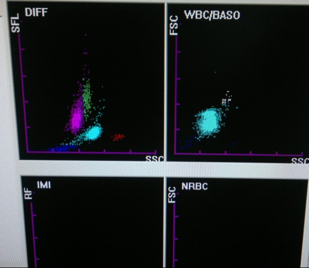 [求助]xe-2100白细胞分类带*-sysmex希森美康血细胞仪
