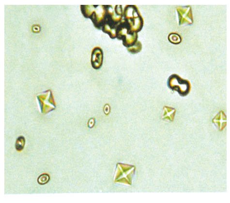 草酸钙结晶图谱图片